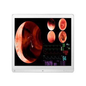 màn hình LG phục vụ cho quá trình phẫu thuật